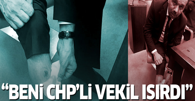 'Bacağımı CHP'li vekil ısırdı'