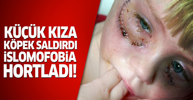 Küçük kıza köpek saldırdı, İslamofobia hortladı!