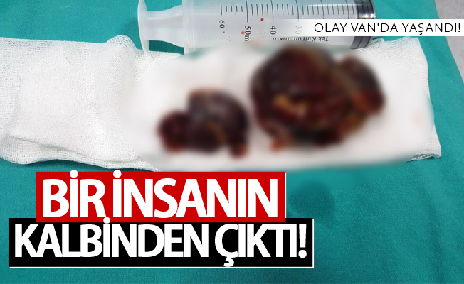 Olay Van'da yaşandı! Bir insanın kalbinden çıktı!