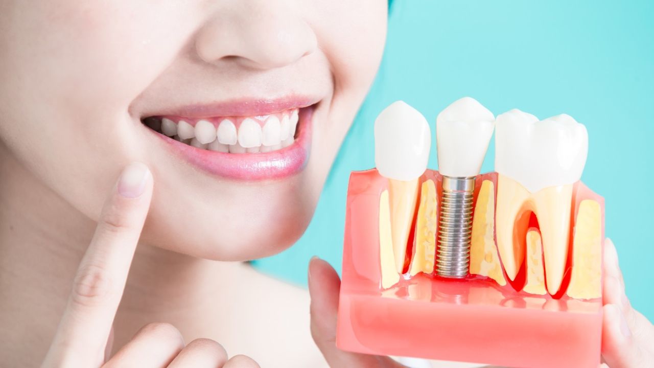 Diş temizliğinde kritik detay! Bunu yapmayanlar dişlerini günden güne kaybediyor 