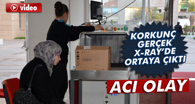 Osmaniye'de X-Rayda korkunç gerçek ortaya çıktı