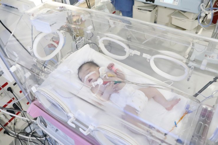 Doğunca Nefessiz Kalacaktı, Annesiyle Bağı Koparılmadan Ameliyat Edildi